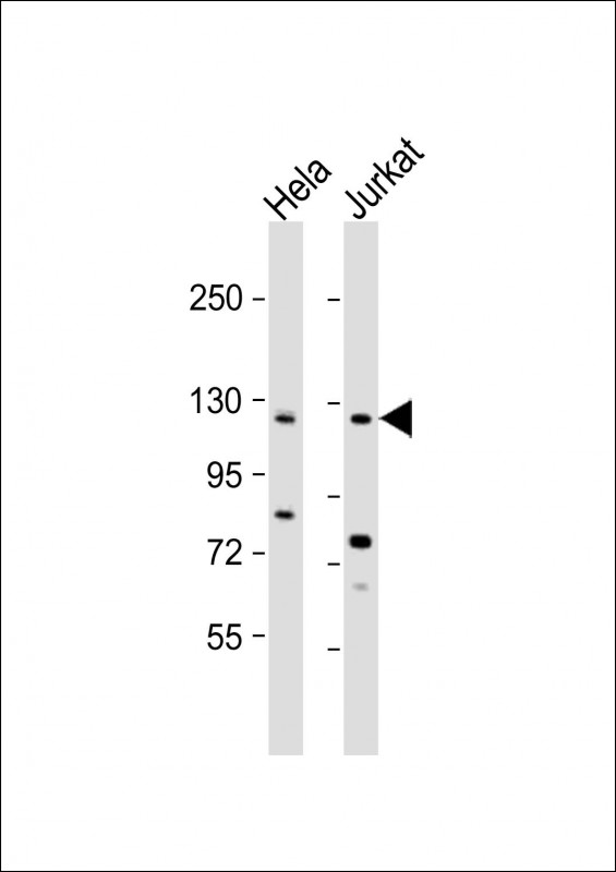 Rabbit Polyclonal Antibody to SRGAP3