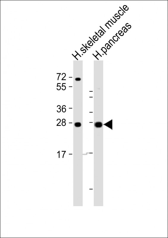 Rabbit Polyclonal Antibody to CELA2B