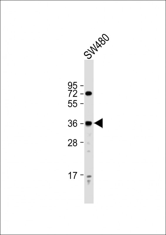 Rabbit Polyclonal Antibody to PRSS23