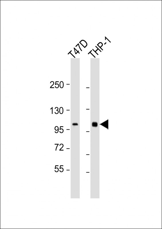 Rabbit Polyclonal Antibody to PLK4