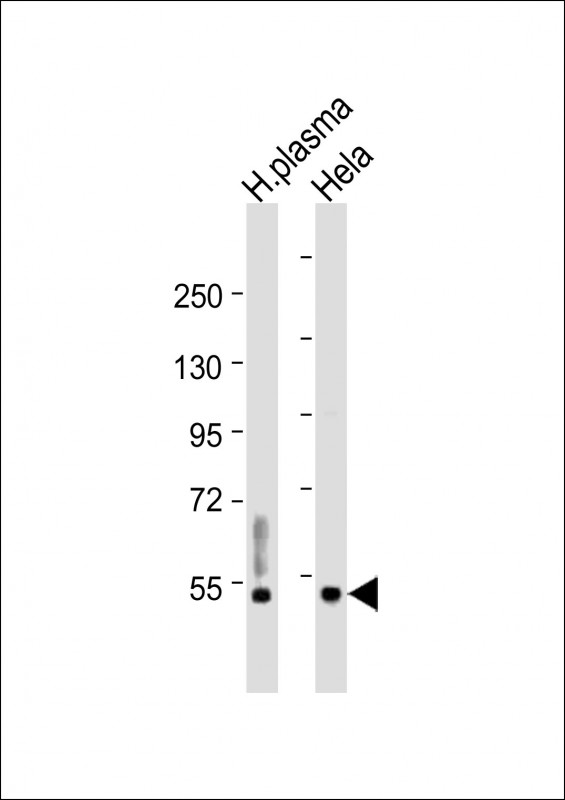 Rabbit Polyclonal Antibody to CFI (light chain)