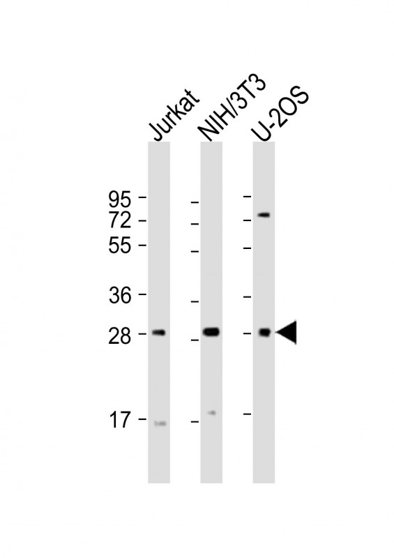 Rabbit Polyclonal Antibody to SIX1