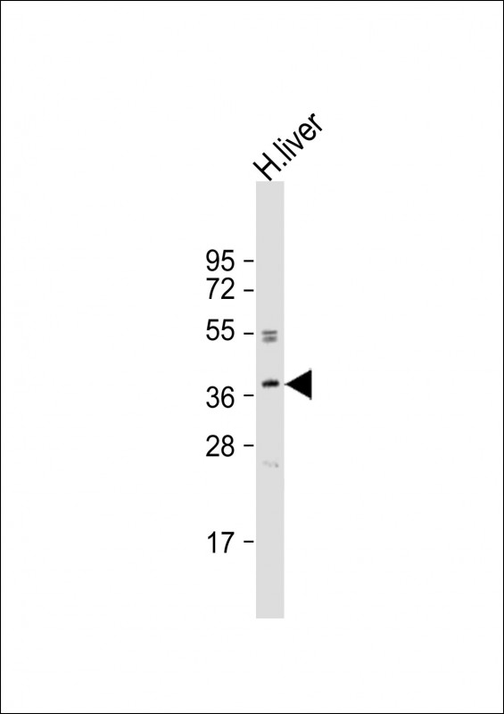 Rabbit Polyclonal Antibody to OR3A2  (C-term)