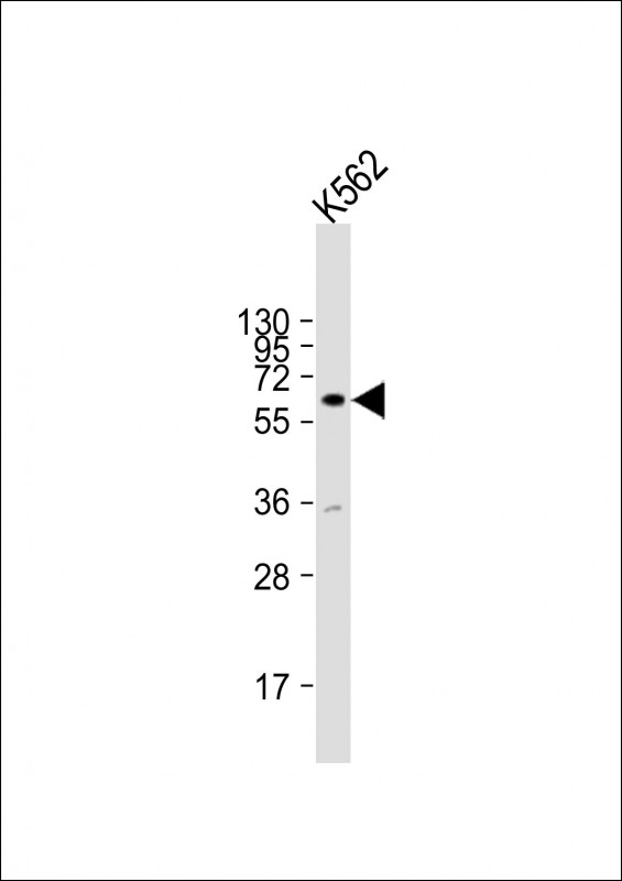 Rabbit Polyclonal Antibody to ZNF280A