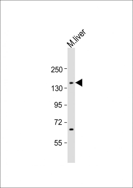 Rabbit Polyclonal Antibody to Mouse Lmtk3