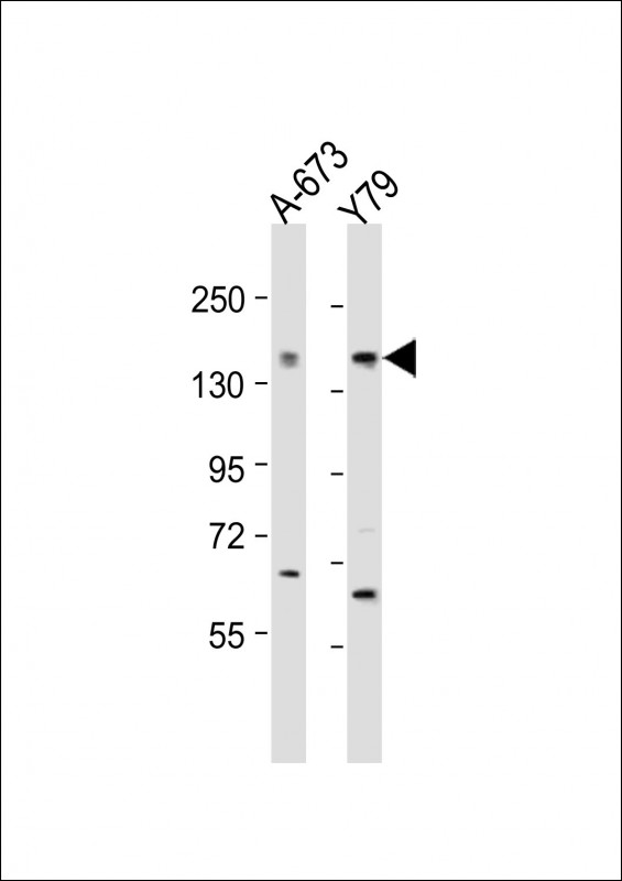 Rabbit Polyclonal Antibody to CACNA1F