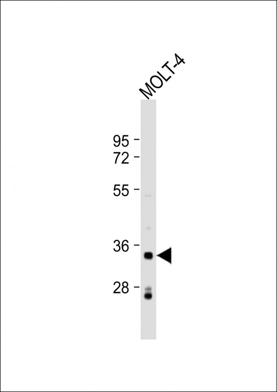 Rabbit Polyclonal Antibody to IMPA2 (N-Term)