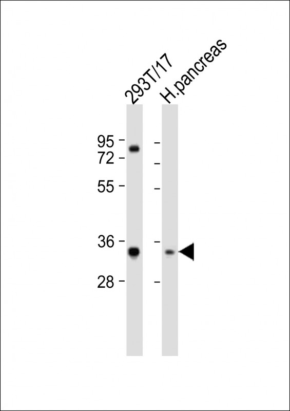 Rabbit Polyclonal Antibody to SHOX (N-term)