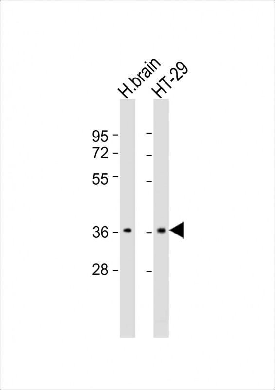 Rabbit Polyclonal Antibody to OR2T7