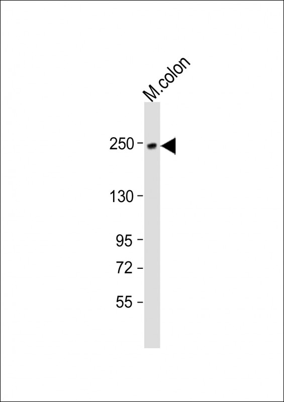 Rabbit Polyclonal Antibody to MYH11 (N-Term)