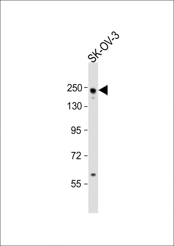 Rabbit Polyclonal Antibody to ARID1A
