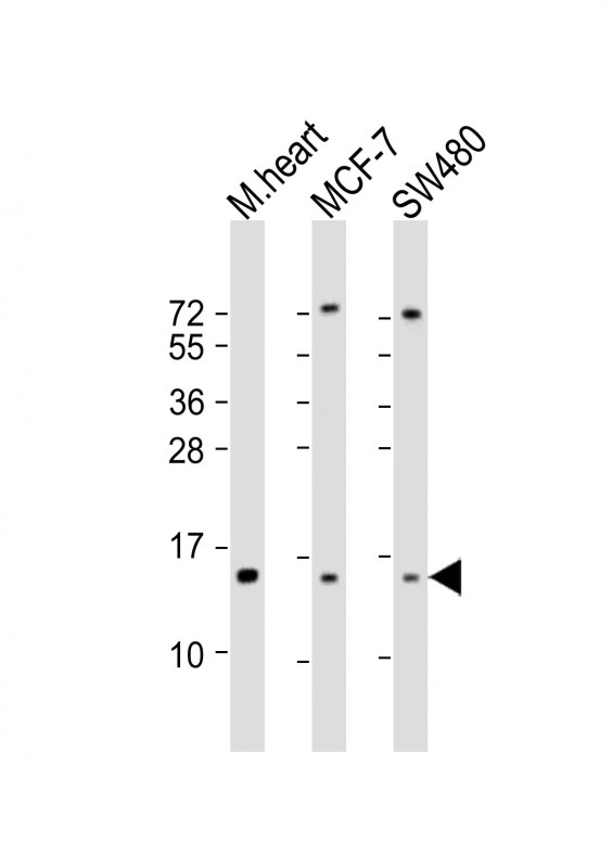 Rabbit Polyclonal Antibody to NDUFA7