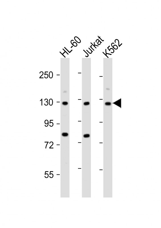 Rabbit Polyclonal Antibody to ATP2A3 (N-Term)