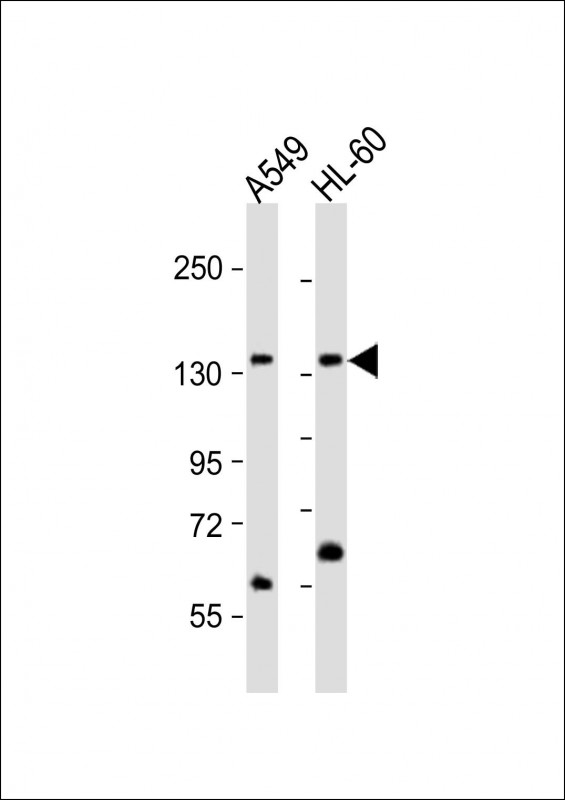 Rabbit Polyclonal Antibody to AFF1