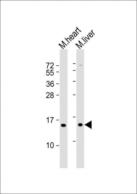 Rabbit Polyclonal Antibody to NDUFA7 (N-Term)