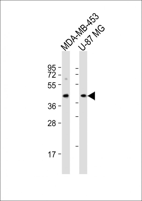Rabbit Polyclonal Antibody to PABPC5