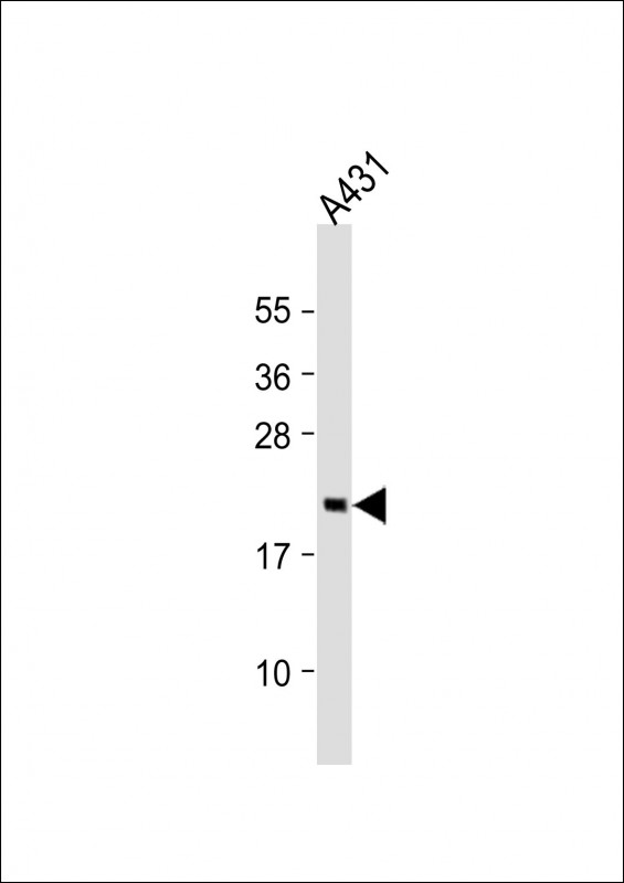 Rabbit Polyclonal Antibody to RAP2A