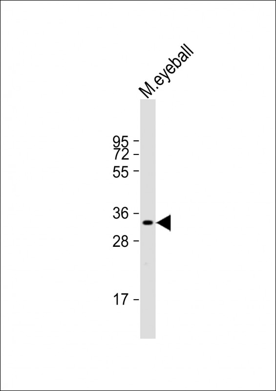 Rabbit Polyclonal Antibody to RLBP1