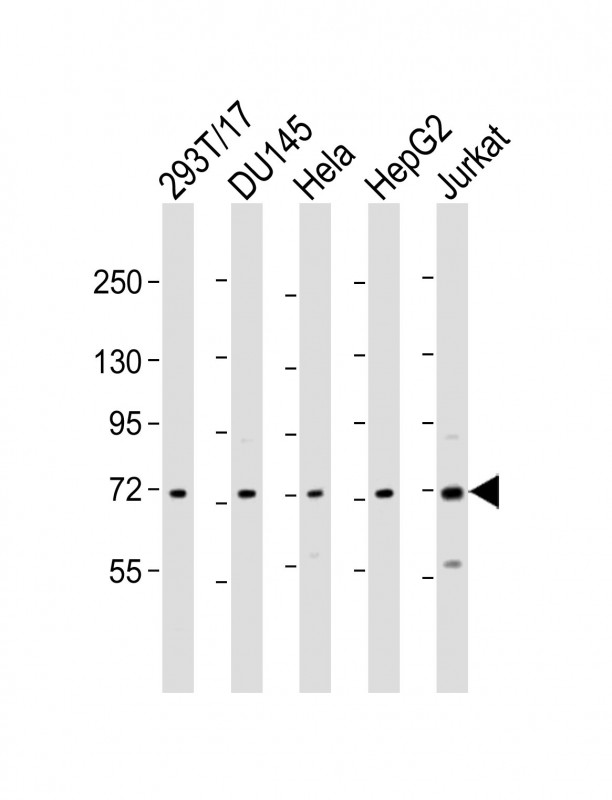 Rabbit Polyclonal Antibody to ZFP64
