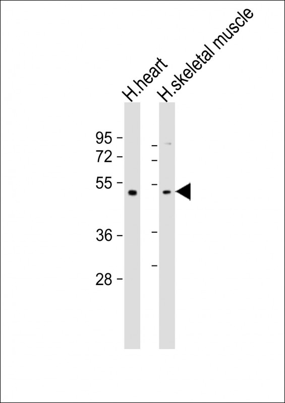 Rabbit Polyclonal Antibody to TRIM55