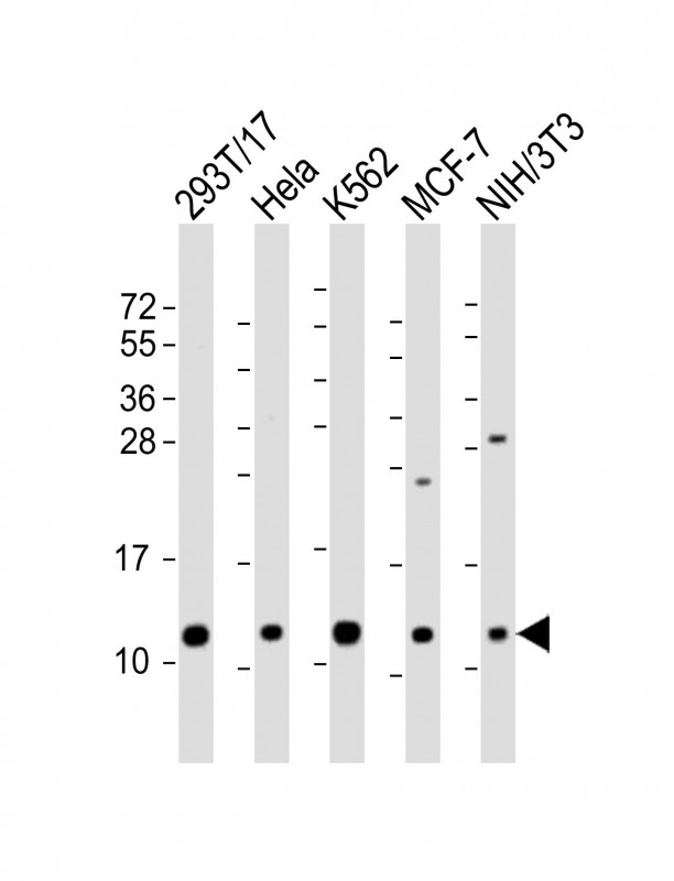 Rabbit Polyclonal Antibody to LSM2