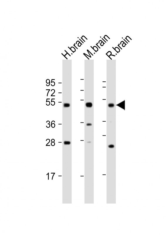 Rabbit Polyclonal Antibody to NPTX1-Y344