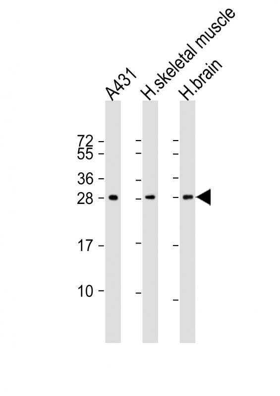 Mouse Monoclonal Antibody to DENR