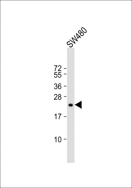 Mouse Monoclonal Antibody to TIMP2