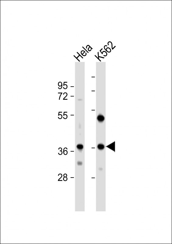 Rabbit Polyclonal Antibody to CTDSPL (N-term)