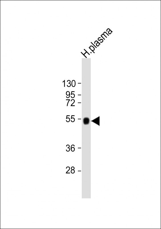 Rabbit Polyclonal Antibody to AHSG