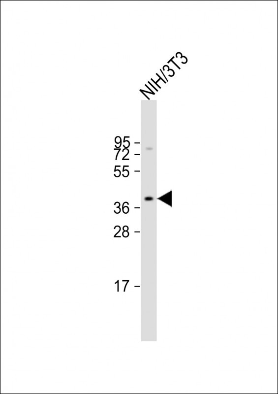 Rabbit Polyclonal Antibody to AGTR1