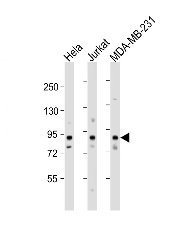 Rabbit Polyclonal Antibody to MYSM1  (N-term)