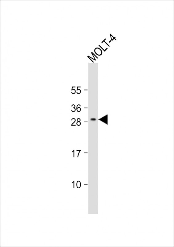 Rabbit Polyclonal Antibody to ALKBH6