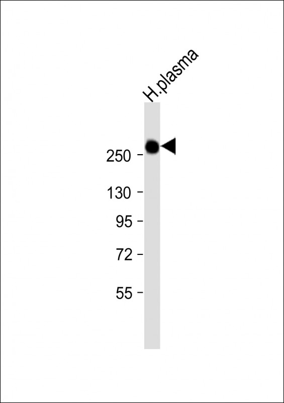Rabbit Polyclonal Antibody to ITIH1