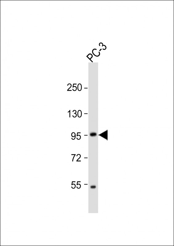 Rabbit Polyclonal Antibody to Mouse Pkn3 (N-term)