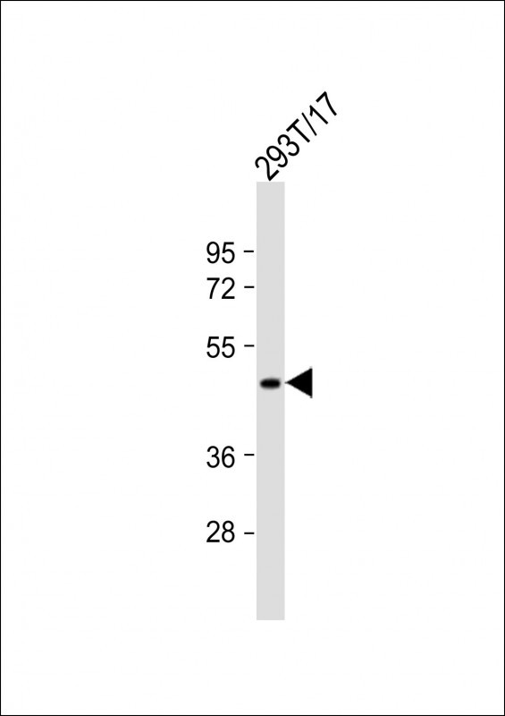 Rabbit Polyclonal Antibody to GPR81