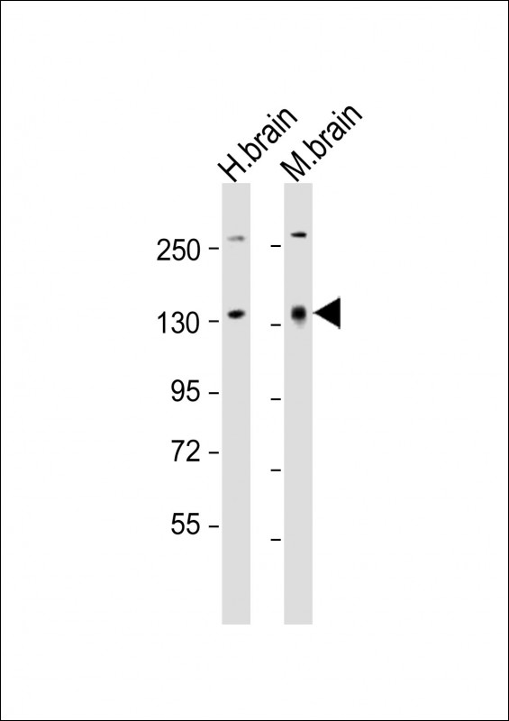 Rabbit Polyclonal Antibody to ATXN2 (N-Term)