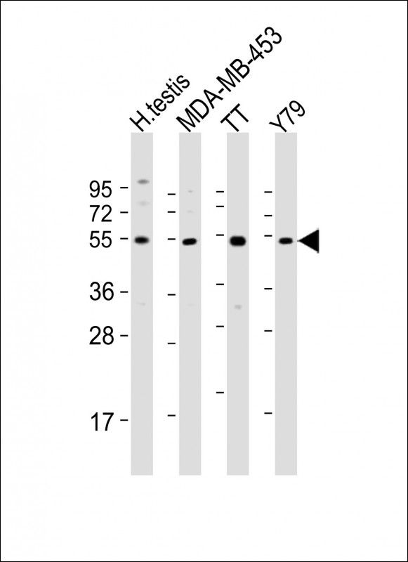 Rabbit Polyclonal Antibody to WDR51B