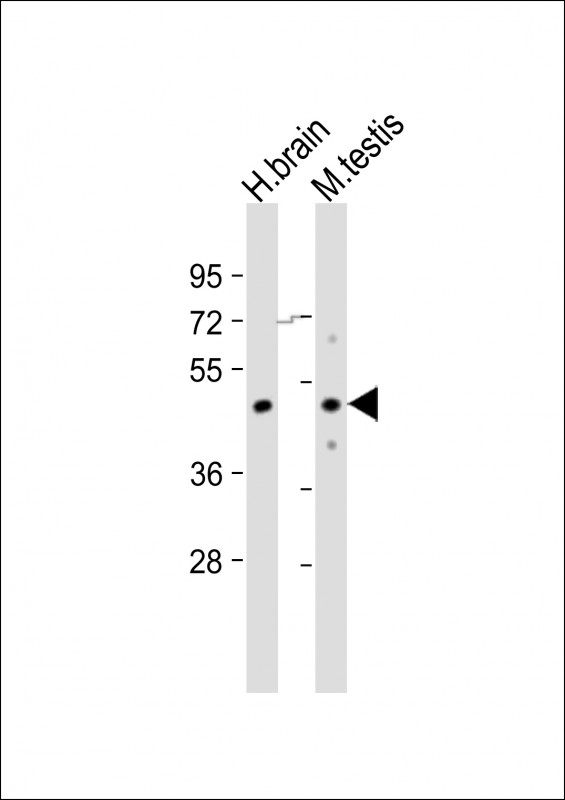 Rabbit Polyclonal Antibody to TGFB3