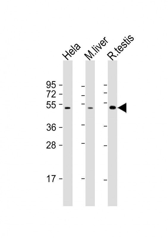 Rabbit Polyclonal Antibody to CHRNB2 (N-Term)