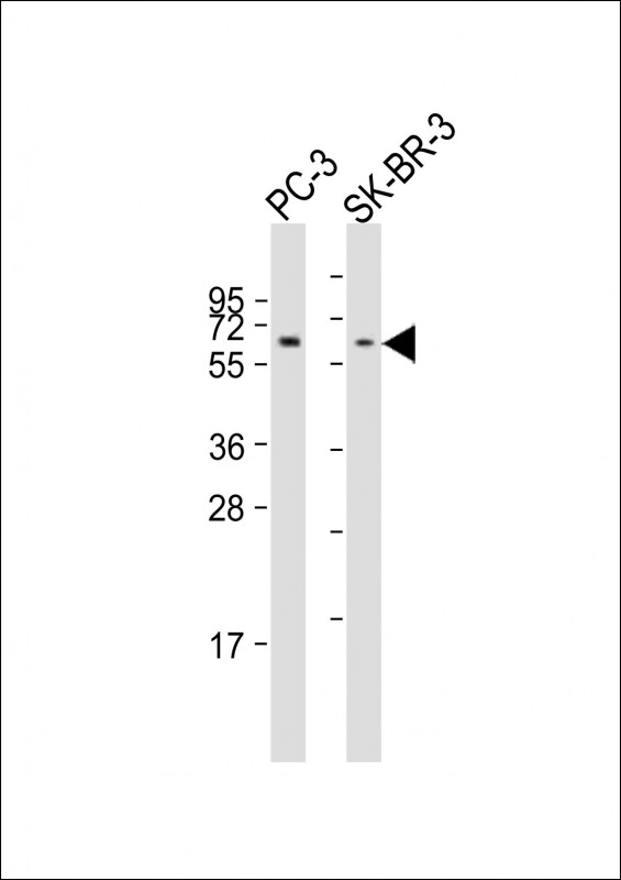 Rabbit Polyclonal Antibody to KAT5