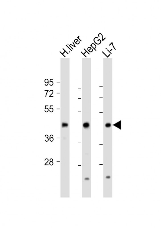 Rabbit Polyclonal Antibody to CREB3L3