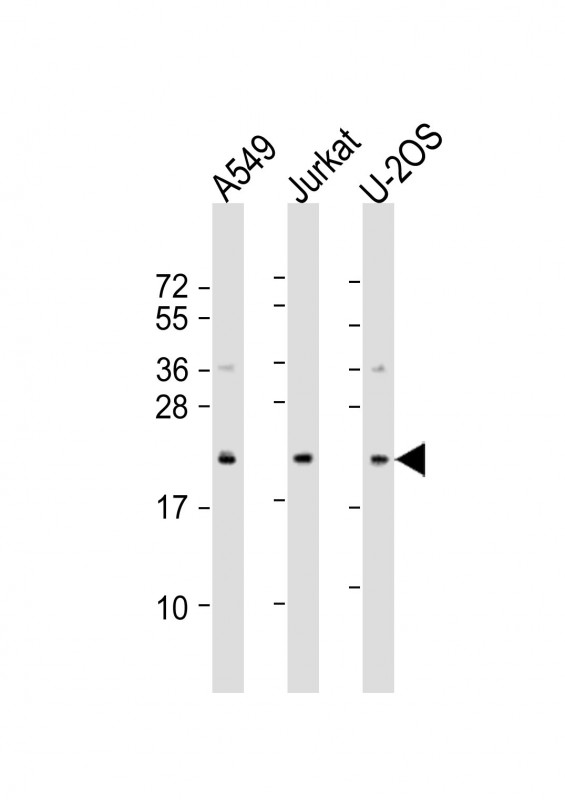 Rabbit Polyclonal Antibody to FAAP24 (N-Term)