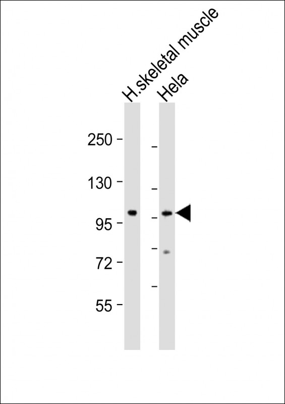 Rabbit Polyclonal Antibody to ATXN2