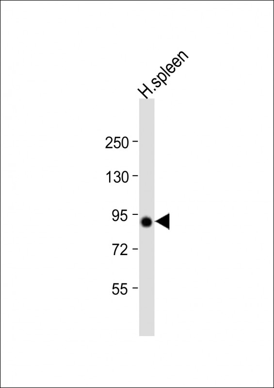Rabbit Polyclonal Antibody to VAC14 (N-Term)