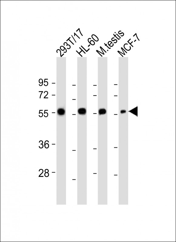 Rabbit Polyclonal Antibody to GMCL1