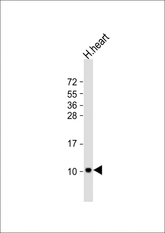 Rabbit Polyclonal Antibody to ATP5EP2