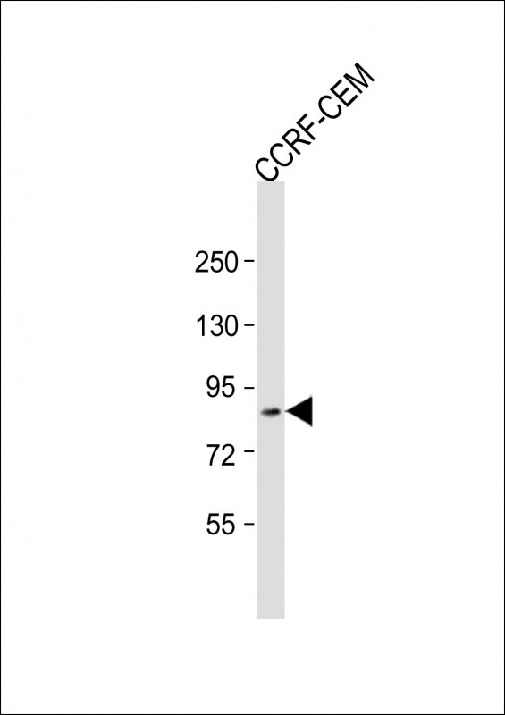 Rabbit Polyclonal Antibody to ZKSCAN5 (N-Term)