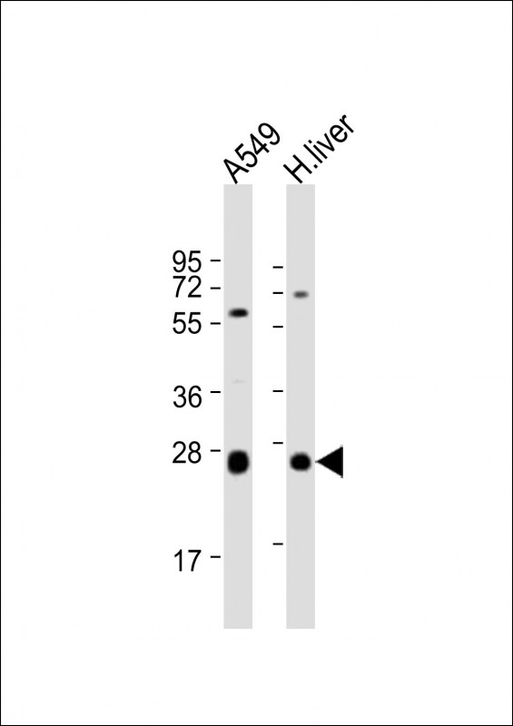 Rabbit Polyclonal Antibody to TRH