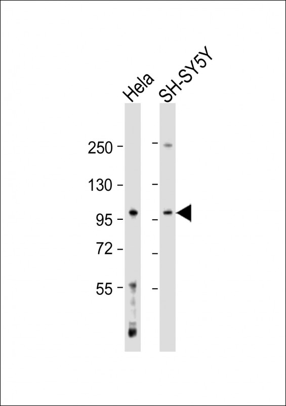 Rabbit Polyclonal Antibody to GABBR1 (N-Term)